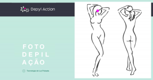 Depilação Feminina de Orelhas com Luz Pulsada Depyl Action