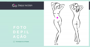 Depilação Feminina de Abdômen com Luz Pulsada Depyl Action